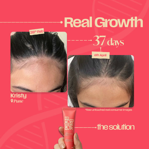 Hair Growth Serum Ampoule- Korean Ingredients V-1
