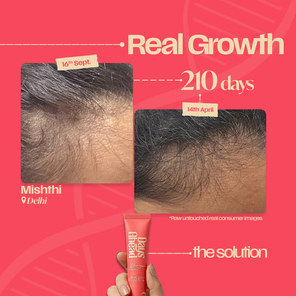 Leave-In Hair Growth Ampoule