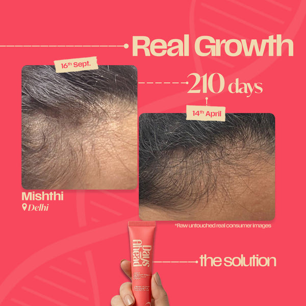 Hairfall Reset Routine