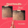 Leave-In Hair Growth Ampoule