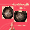 Hair Growth Roll-On Serum Ampoule
