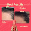 Hair Growth Serum Ampoule- Korean Ingredients V-1