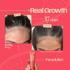 Hair Growth Serum Ampoule- Korean Ingredients V-1