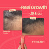 Hairfall Reset Routine