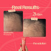 Hairfall Reset Routine