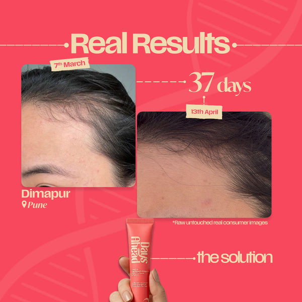 2-Min Leave-In Hair Growth Ampoule