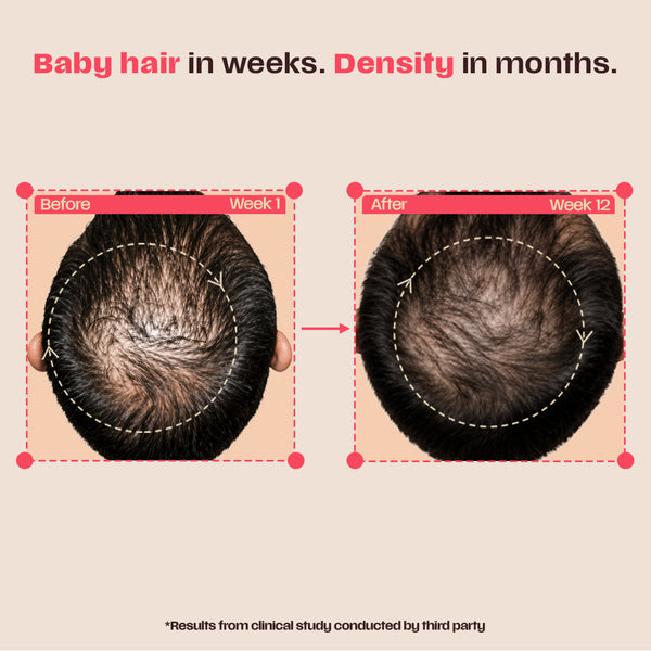 Leave-in Hair Growth Serum