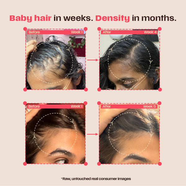 Leave-in Hair Growth Serum