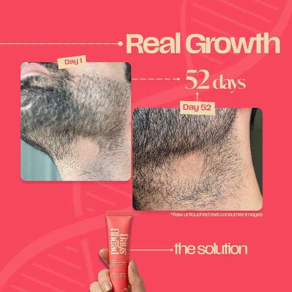Hair Growth Roll-On Serum Ampoule