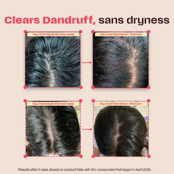 Pre-wash Reset Serum - Dandruff