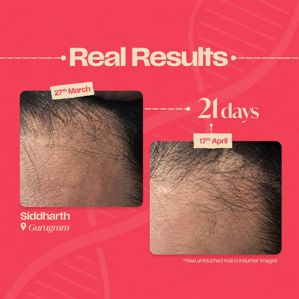 Flake-Free Growth RESET ROUTINE