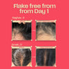 Flake-Free Growth RESET ROUTINE